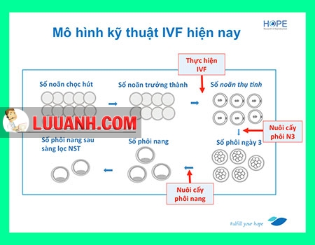 ivf