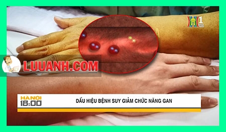gan